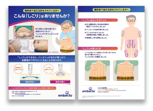リポハイパートロフィー予防パンフレット